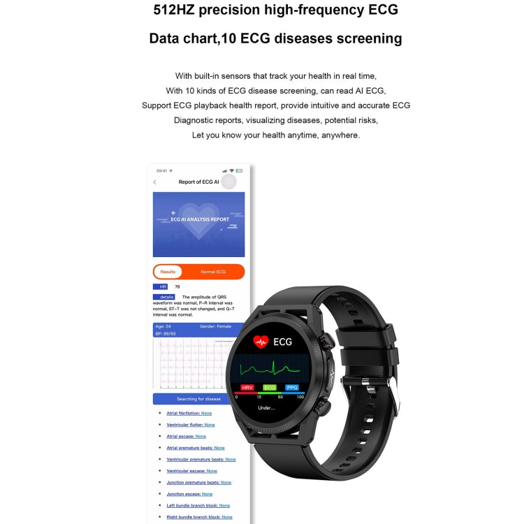 ET310 1,39 pouces IPS écran IP67 montre intelligente bande de silicone étanche, prise en charge de la surveillance de la température corporelle/ECG, ET310