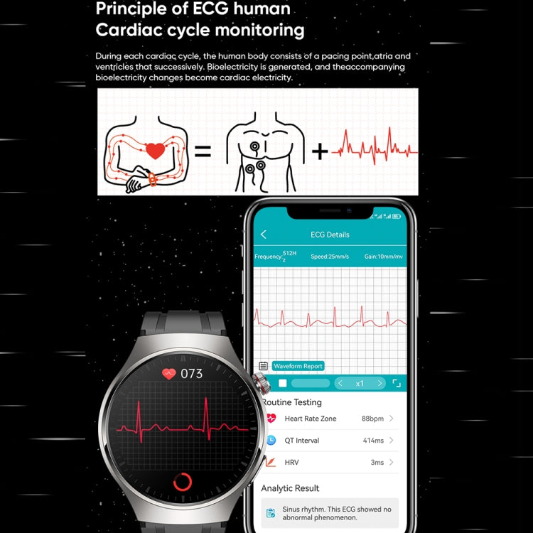 MT200 1,43 pouces AMOLED IP67 montre d'appel intelligente, prise en charge de la surveillance ECG/température corporelle/glycémie