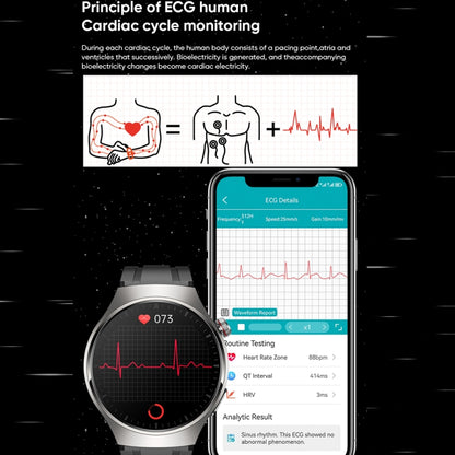 MT200 1,43 pouces AMOLED IP67 montre d'appel intelligente, prise en charge de la surveillance ECG/température corporelle/glycémie