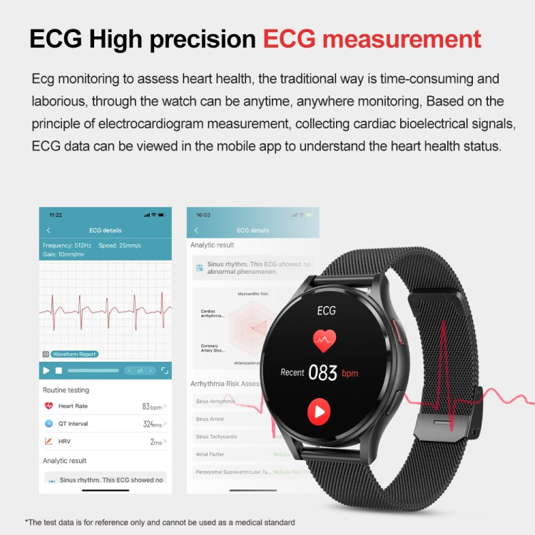 Montre intelligente avec bracelet en acier milanais de 1,43 pouces, appel Bluetooth, prise en charge ECG/glycémie Non invasive, Milanese Steel Strap Black, Milanese Steel Strap Rose Gold